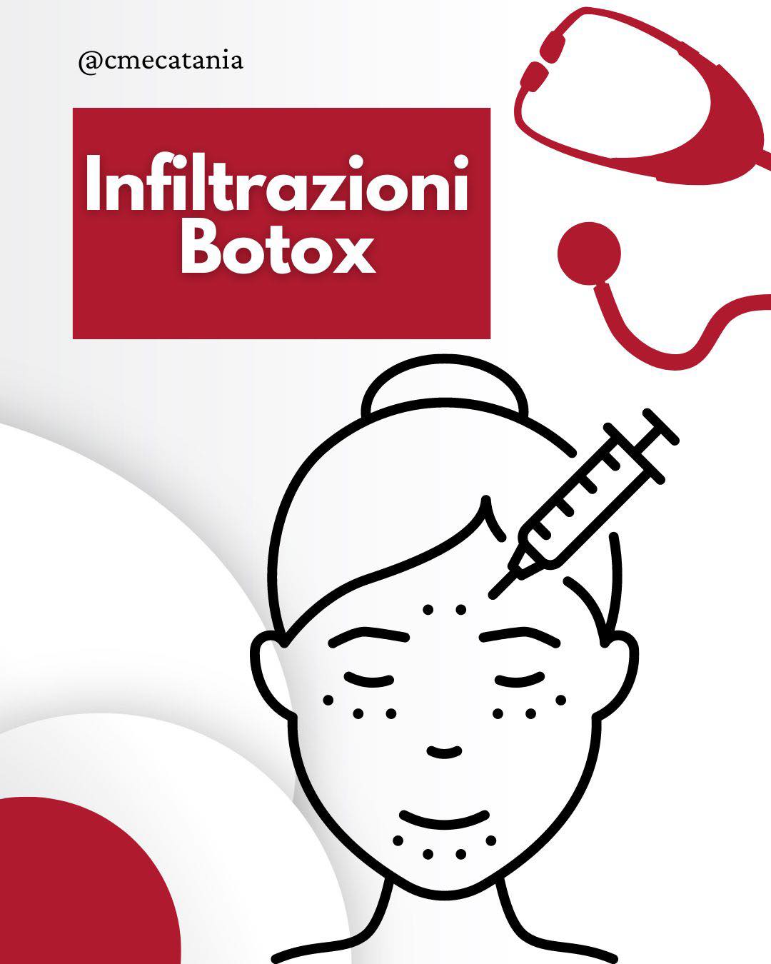 Cosa sono le infiltrazioni di Botox?